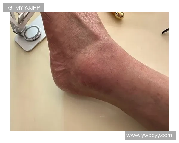 足球球星护踝装备解析 如何选择适合自己的护踝保护装备