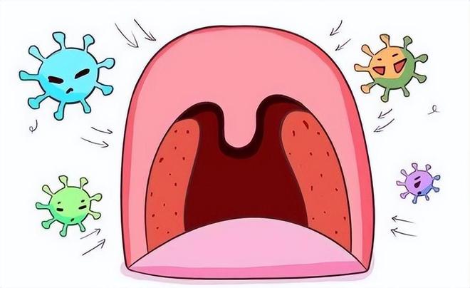 九游体育经常扁桃体发炎怎么办？这些原因都易引起发炎！出现症状及时就医(图5)
